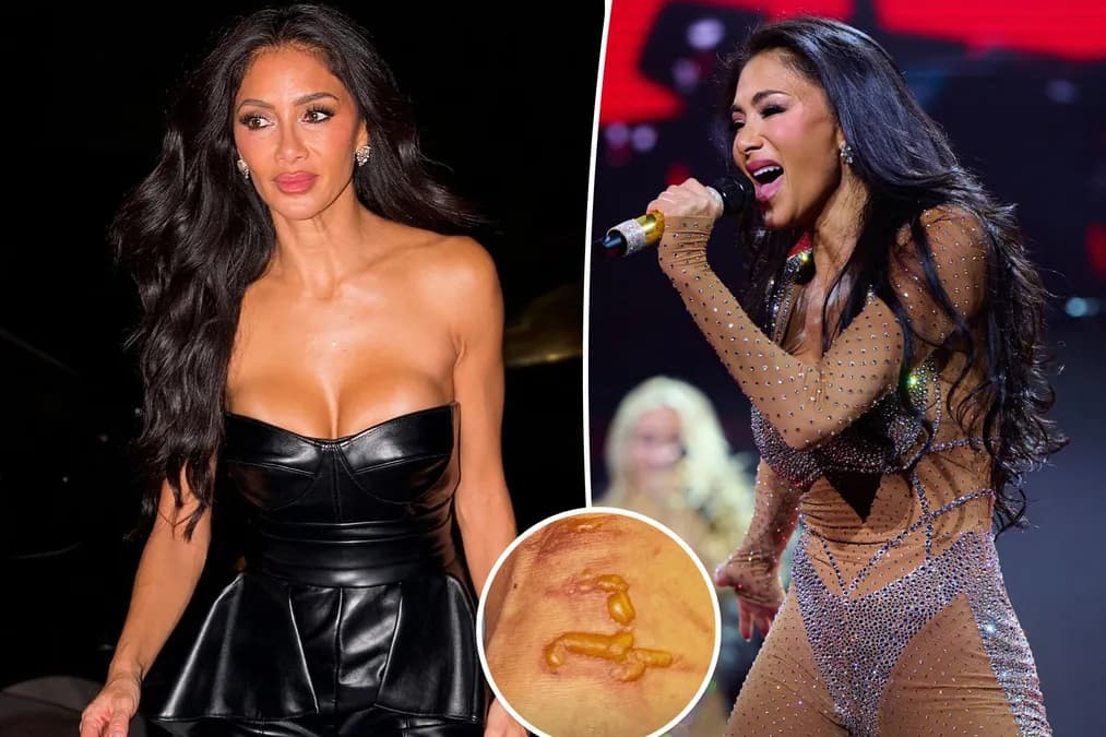 Nicole Scherzinger persévère sur scène après une brûlure à l'eau bouillante avant le concert